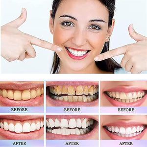 Oralhoe - Nicotinamide Dazzle White Toothpaste (Original)